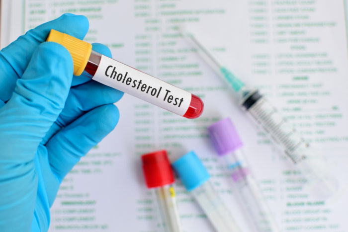 cholesterol check must fast