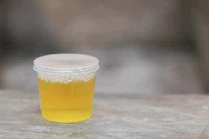 urine formation