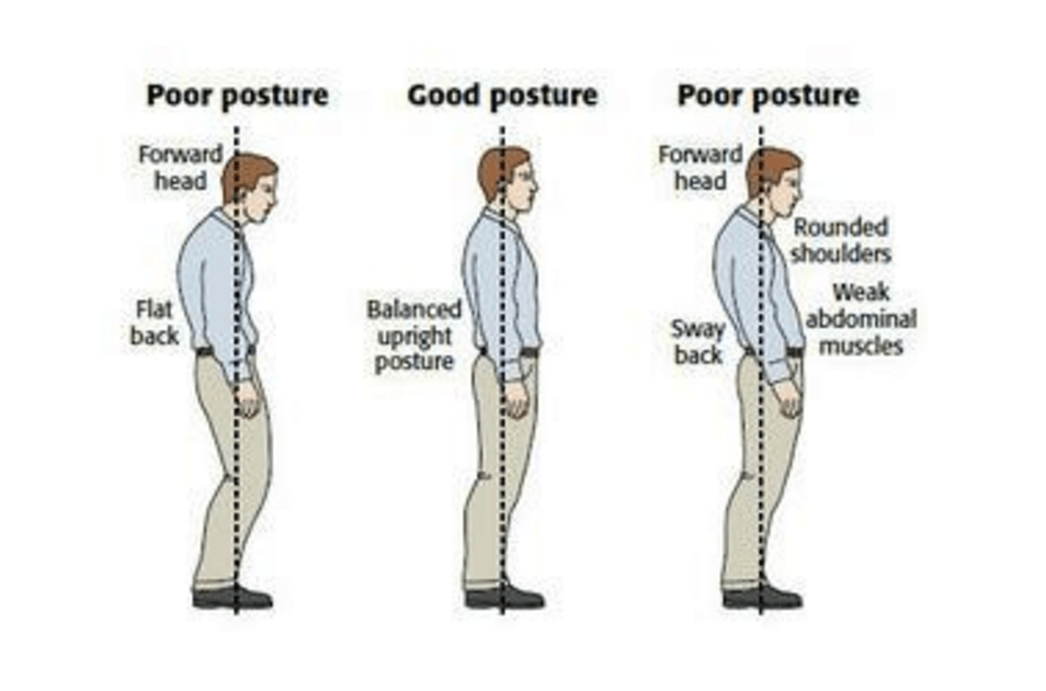 Image source: http://www.thephysiocompany.com/blog/stop-slouching-postural-dysfunction-symptoms-causes-and-treatment-of-bad-posture