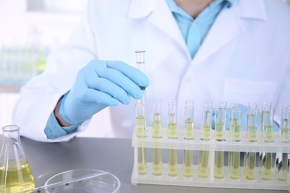 check aging with a urine test