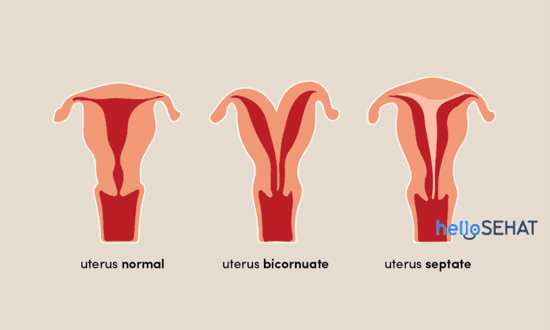 abnormalities in the uterus