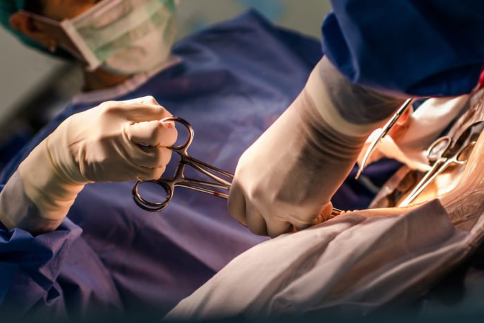how many times a caesarean section can be done