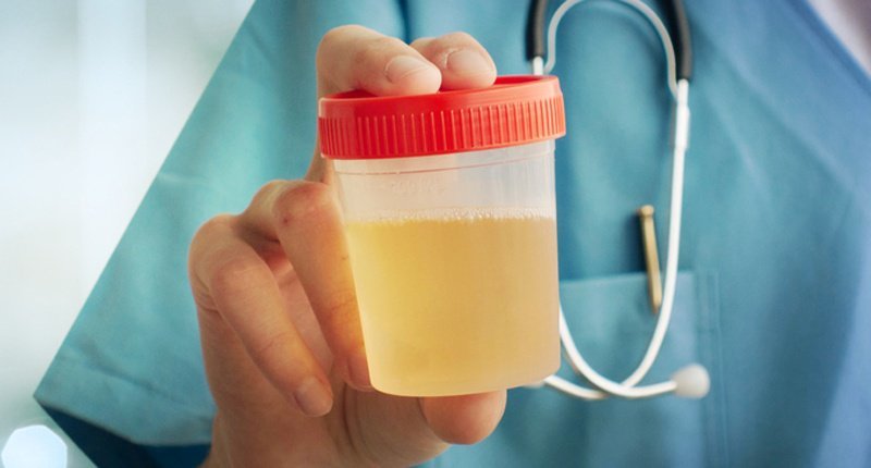amniotic fluid and urine