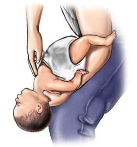 Steps to help choking babies (4-5) source: www.webmd.com
