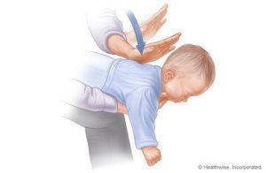 Steps to help choking babies (1-3) sources: www.webmd.com