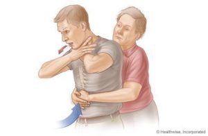 Steps to help choking people (source: webmd.com)