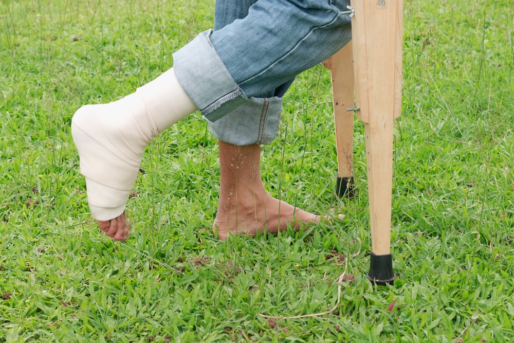 the way after a leg fracture