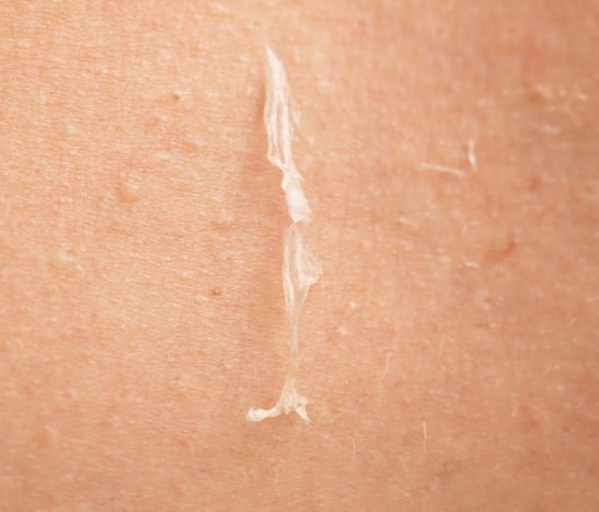 causes of overcoming peeling skin