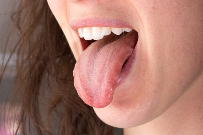 mouth feels bitter when fasting