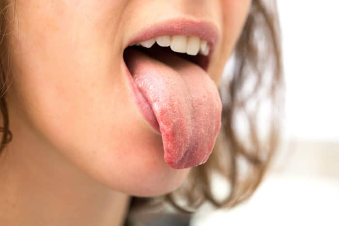 the cause of tongue itching