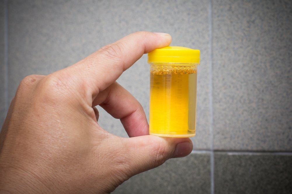 urine therapy to drink urine