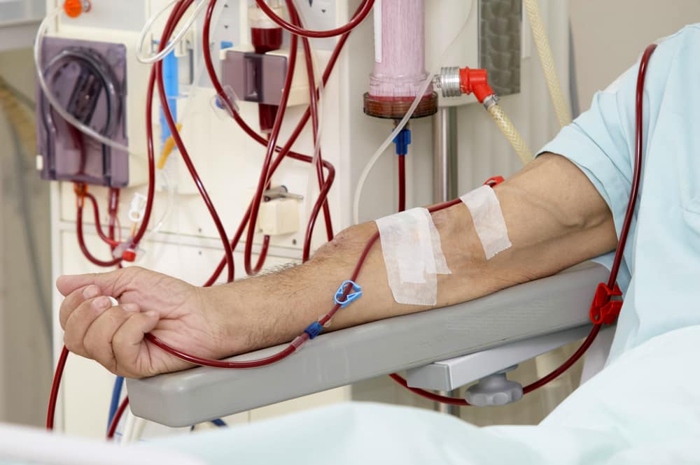 the result if late dialysis