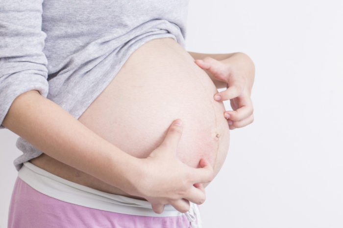 Pruritic folliculitis is the cause of itchy skin during pregnancy